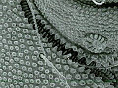 Tullbergia sp. (Collembola) from Tasmania
Post-antennal organ and pseudocellus
After Ireson JE, 1990 Fig.70