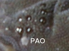 Pseudachorutes parvulus (Collembola) from Belgium
Post-antennal organ (PAO) with 6 vesicles
2019.09.01 © Huskens, M.-L.