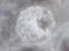 Pseudachorutes parvulus ♂ (Collembola) from Belgium
Genital plate with star-shaped orifice
2019.09.01 © Huskens, M.-L.