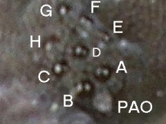 Pseudachorutes parvulus (Collembola) from Belgium
Post-antennal organ (PAO) with 6 vesicles
2019.09.01 © Huskens, M.-L.