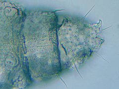 Mesaphorura sp. (Collembola) from Canada
Abd.6 with crescentic ridges and anal spines
2021.11.26 © Brousseau, P.-M.