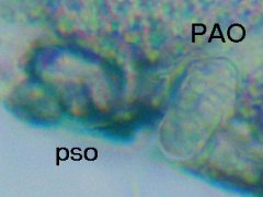 Mesaphorura sp. (Collembola) from Canada
Anterior pseudocellus (pso); post-antennal organ (PAO) with 2 parallel rows of vesicles
2021.11.26 © Brousseau, P.-M.