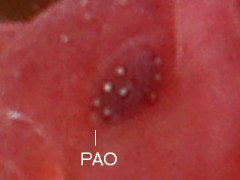 Brachystomella parvula (Collembola) from France
Eyepatch with 8 ocelli; post-antennal organ (PAO)
2017.11.25 © Picard, J.