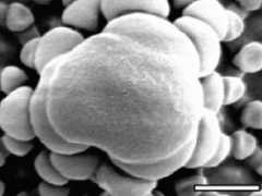 Stenaphorura quadrispina (bar=500nm)
Epicuticular secondary granule
After Nickerl J & al, 2012 Fig.2C''