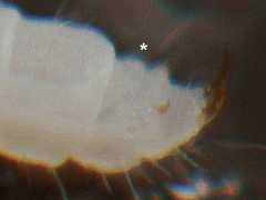 Stenaphorura denisi (Collembola) from the UK
Two large and two small anal spines; in front two bumps (*)
2012.11.28 © Murray, A.