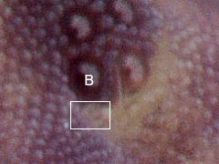 Brachystomella villalobosi (Collembola) from the USA
Postantennal organ subequal to ocellus B
With 4 lobes
2024.02.29 © Gruver, Be.