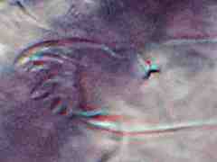 Brachystomella neomexicana (Collembola) from the USA
Blunt-toothed maxilla
2016.02.19 © Janssens, F.
Leg.: Vitanza, S.