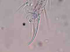 Brachystomella neomexicana (Collembola) from the USA
Unguiculus absent (*)
2016.02.19 © Janssens, F.
Leg.: Vitanza, S.