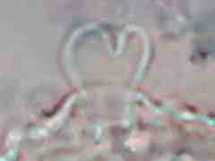 Brachystomella neomexicana (Collembola) from the USA
Trilobed apical bulb of ant.4
2016.02.19 © Janssens, F.
Leg.: Vitanza, S.