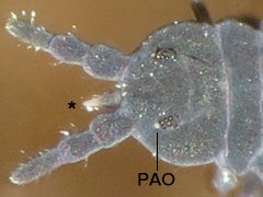 Pseudachorutes sp. (Collembola) from the USA
Pointed mouthcone (*)
Post-antennal organ round (PAO)
2022.01.12 © Parker, H.S.