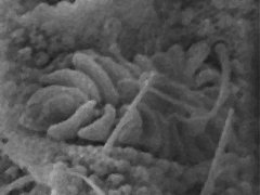 Mesaphorurinae (Collembola) from the USA
Post-antennal organ with 2 rows of 12 vesicles
2020.06.19 © Speer, J.H.