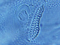 Pongeiella silvicola juv. (Collembola) from the USA
Post-antennal organ with 2 rows of vesicles and outer part with 3 rows
2024.08.26 © Wang, G.