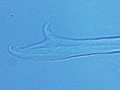 Pseudachorutes aphysus (Collembola) from the USA
Mandibula apex
2023.12.16 © Wang, G.