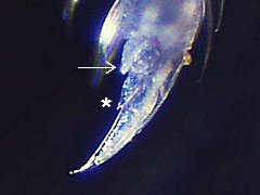 Pseudachorutes aphysus (Collembola) from the USA
Third foot
With reduced unguiculus and inner tooth (*)
2023.01.03 © Wang, G.