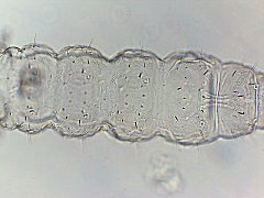 Tullbergia arctica (Collembola) from the USA
Abd.1-4 with 2+2 pseudocelli
Abd.5 with 1+1 pseudocelli
2023.10.28 © Wang, G.
